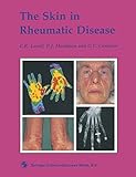 The skin in rheumatic disease