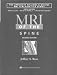 MRI of the Spine (Raven Mri Teaching File)