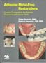 Adhesive Metal-Free Restorations: Current Concepts for the Esthetic Treatment of Posterior Teeth