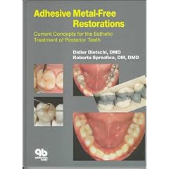 Adhesive Metal-Free Restorations: Current Concepts in the Aesthetic Treatment of Posterior Teeth