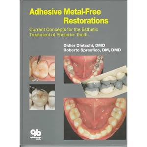 Click here to buy Adhesive Metal-Free Restorations: Current Concepts for the Esthetic Treatment of... by Didier Dietschi and Roberto Spreafico.