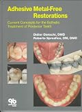 Adhesive Metal-Free Restorations: Current Concepts for the Esthetic Treatment of Posterior Teeth