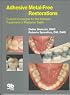 Adhesive Metal-Free Restorations: Current Concepts for the Esthetic Treatment of Posterior Teeth