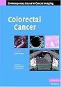 Colorectal Cancer (Contemporary Issues in Cancer Imaging)
