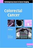 Colorectal Cancer (Contemporary Issues in Cancer Imaging)
