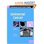 Colorectal Cancer (Contemporary Issues in Cancer Imaging)