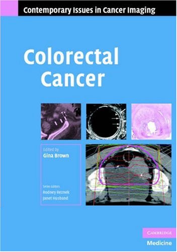 Colon-Cancer