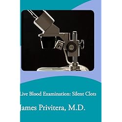 Live Blood Examination: Silent Clots