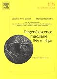 D�g�n�rescence maculaire li�e � l'�ge