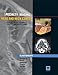 Specialty Imaging Head and Neck Cancer: State of the Art Diagnosis, Staging, and Surveillance