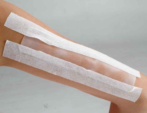 Scar Management Silicone Sheet 4 cm x 30.5 cm (1.6"x 12") Guaranteed Scar Treatment. Includes 1 Washable and Reusable Silicone Sheet. Effective for 6 Months of Treatment - Results in 1 - 2 Weeks - Average Healing Time 1 - 3 Months