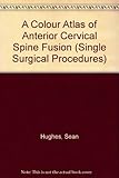 A colour atlas of anterior cervical spine fusion