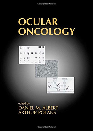 ocular oncology