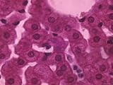 Liver(Hepatic) Cells Kupffer Cells, X400 Photographic Poster Print, 32x24