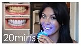 Dial a Smile Teeth Whitening Kit 410zzfhJvJL. SL160 Dial a Smile Teeth Whitening Kit