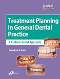 Treatment Planning in General Dental Practice (Dental Update)