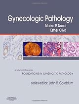 Gynecologic Pathology: A Volume in Foundations in Diagnostic Pathology Series, 1e