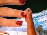 MICROPREMATURE BABIES: HOW LOW CAN YOU GO?