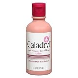 Skeeter Syndrome Treatment - Caladryl Lotion, Calamine Plus Itch Reliever, 6-Ounce Bottle