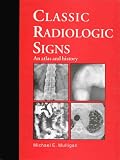 Classic Radiologic Signs: An Atlas and History