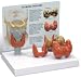 Human Thyroid Diseases/Conditions Anatomical Set #3150
