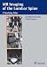MR Imaging of the Lumbar Spine: A Teaching Atlas con Libri relativi al nominativo: 4119REJaNGL._SL75_