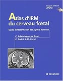 Atlas d'irm du cerveau foetal  normaux