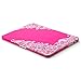Kuzy - Lace Rubberized Hard Case for Older MacBook Pro 15.4 inch with Retina Display A1398 15 inch Plastic Shell Cover - Lace Neon Pink