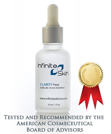 salicylic acid peel