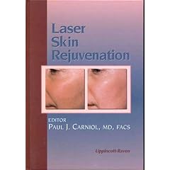 Laser Skin Rejuvenation