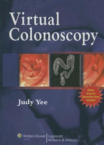Computed-Tomography