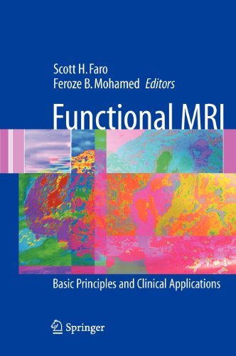 Functional MRI: Basic Principles and Clinical Applications On Sale