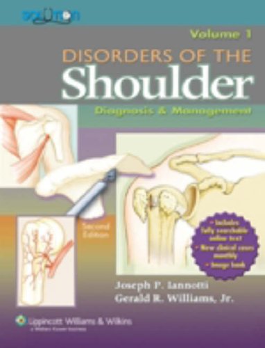 Musculoskeletal Disorders