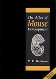 The Atlas of Mouse Development