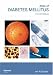 Book An Atlas of Diabetes Mellitus, Second Edition (The Encyclopedia of Visual Medicine Series)