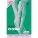 Your Guide to Eczema (A Hodder Arnold Publication)