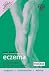 Your Guide to Eczema (A Hodder Arnold Publication)