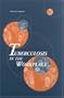 Tuberculosis in the Workplace