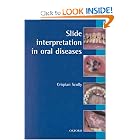 Click here to buy Slide Interpretation in Oral Diseases (Oxford Medical Publications) by Crispian Scully.