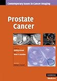 Prostate cancer