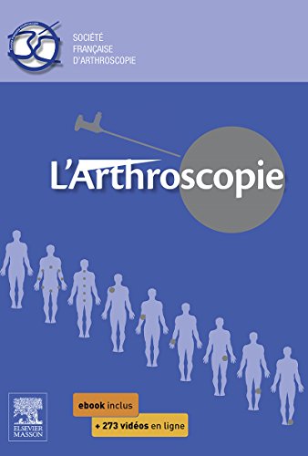 L'arthroscopie (French Edition)