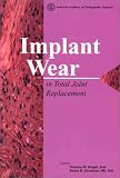 Implant Wear in Total Joint Replacement: Clinical and Biological Issues, Material and Design Considerations