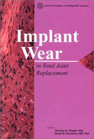 Implant Wear in Total Joint Replacement: Clinical and Biological Issues, Material and Design Considerations