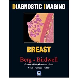 Click here to buy Diagnostic Imaging: Breast by Wendie A. Berg, Robyn L. Birdwell, Eva Gombos, and Shih-Chang Wang.