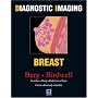 Diagnostic Imaging: Breast