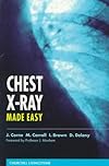 Chest X-Ray Made Easy (Made Easy)