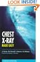 Chest X-Ray Made Easy, 1e