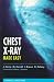 Chest X-ray Made Easy
