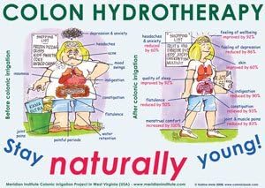 Stay Naturally Young Colon Hydrotherapy Marketing Poster (Glossy A2 597 x 420 mm) by Colonic Book