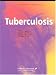 Tuberculosis